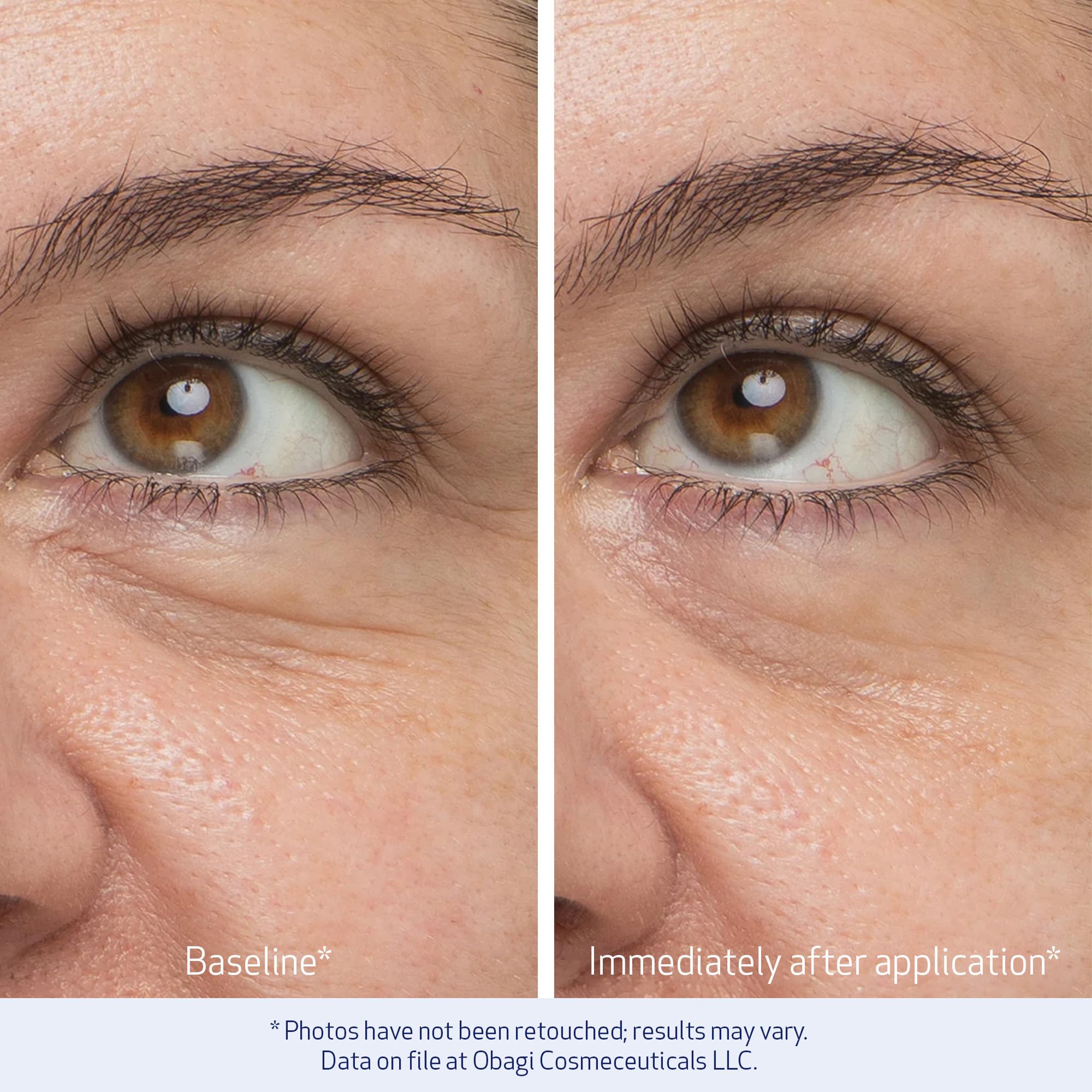 Obagi Daily Hydro-Drops Eye Gel packaging box on a clean surface.