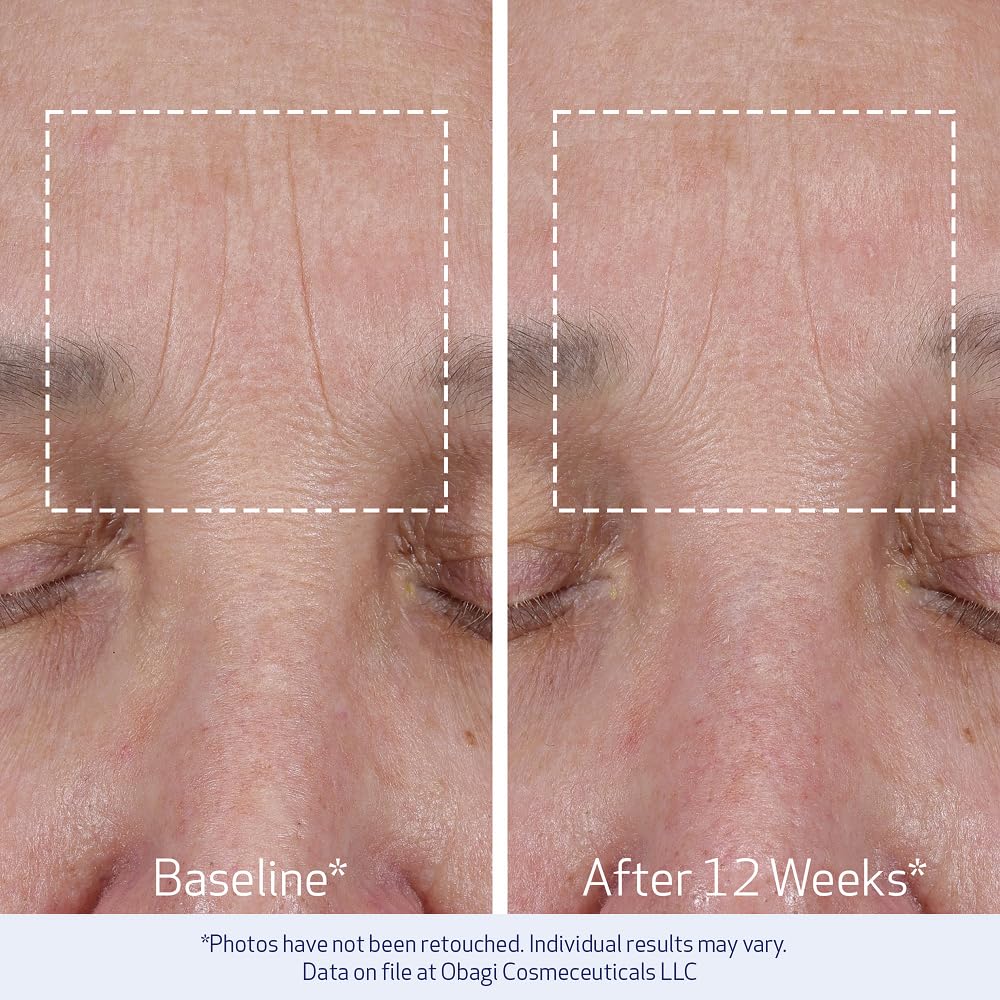 User applying ELASTIderm along the jawline to refine contours.