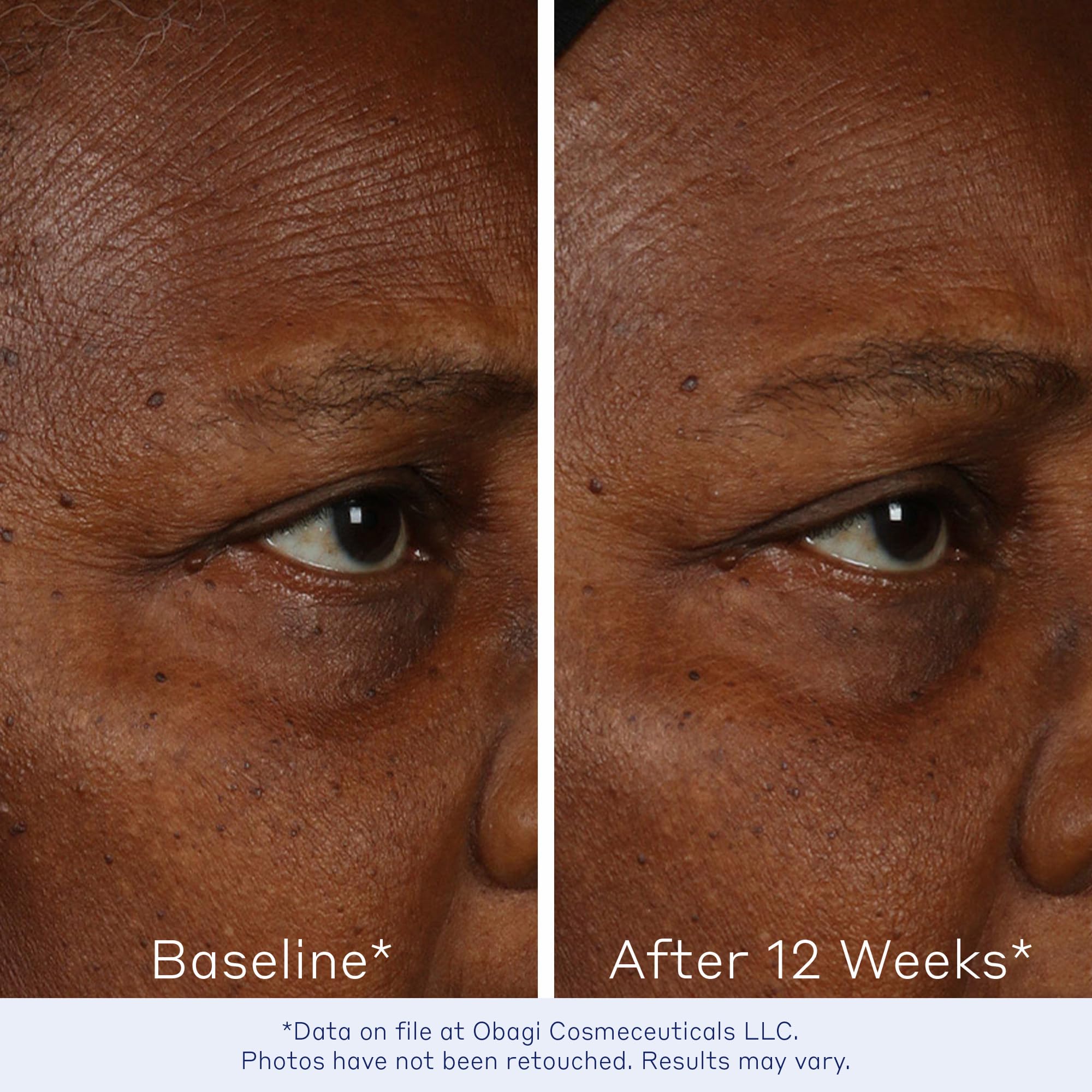 Obagi Elastiderm serum pump dispense captured for easy daily dosing.