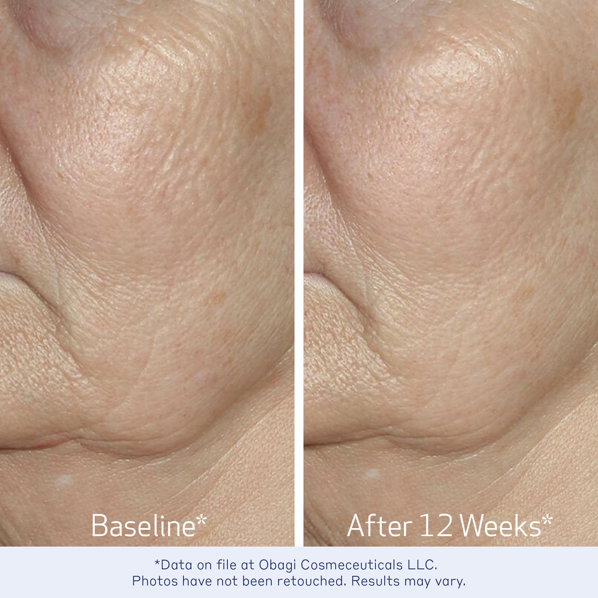 Obagi Elastiderm serum texture on hand shows quick absorption.