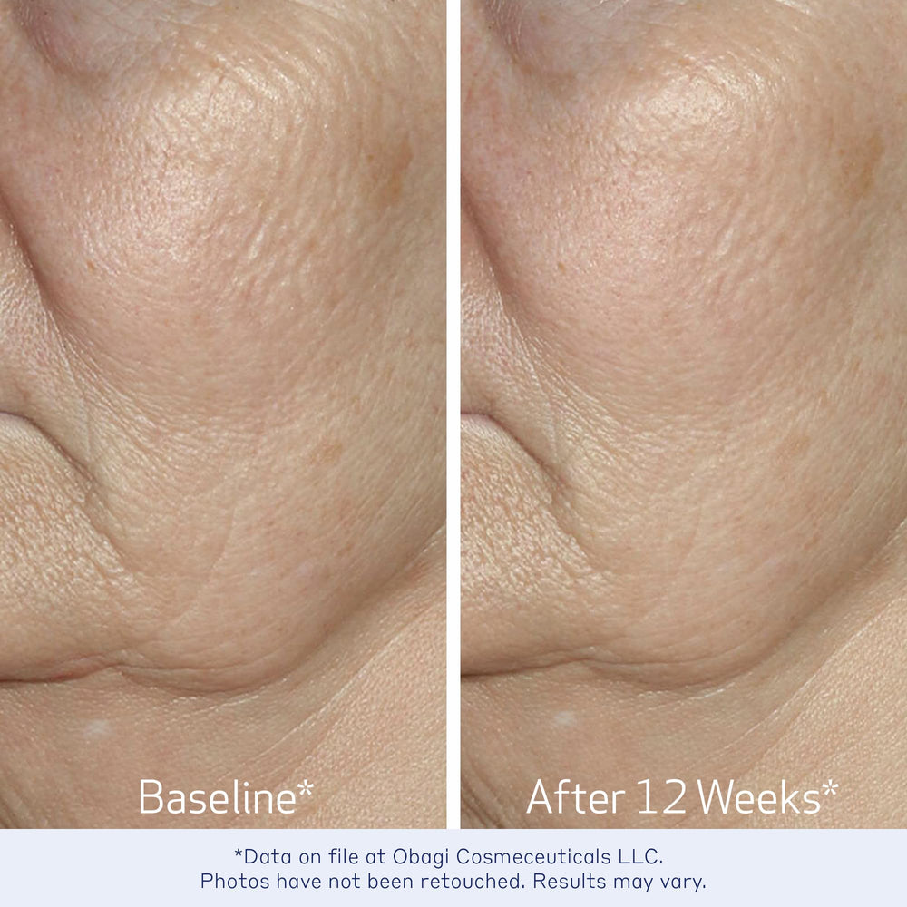 Obagi Elastiderm serum texture on hand shows quick absorption.