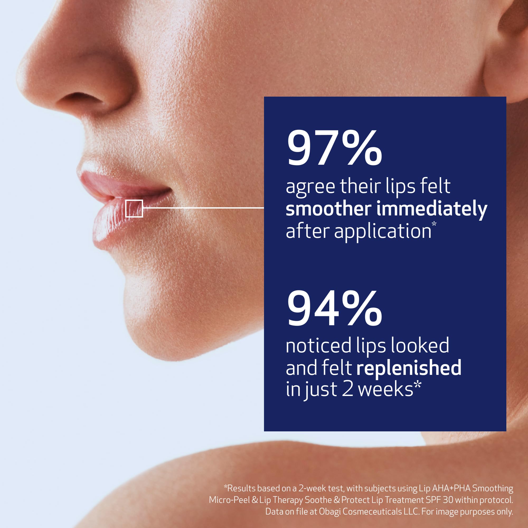 Close-up shows refined lip texture after Obagi smoothing therapy