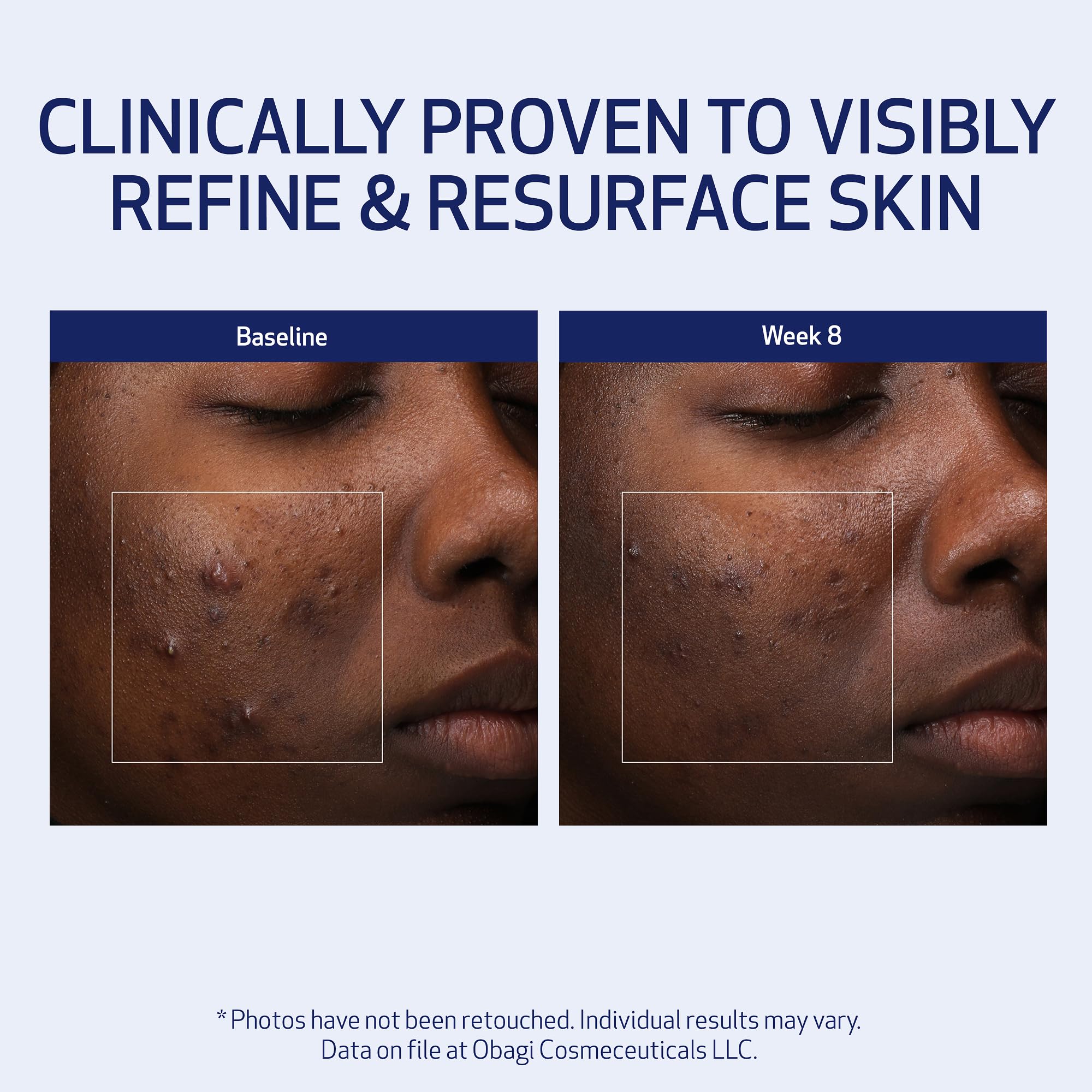 Obagi Retinol and PHA at night scene supports a consistent skincare routine