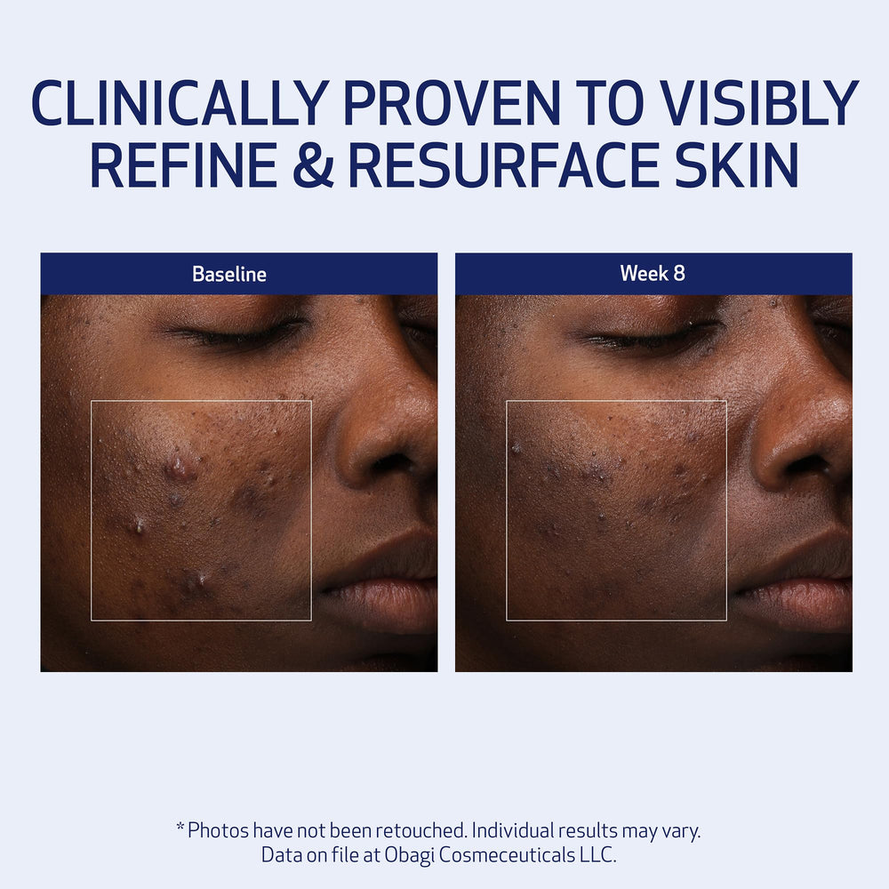 Obagi Retinol and PHA at night scene supports a consistent skincare routine