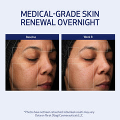 Obagi Medical night cream on vanity display conveying premium overnight treatment for renewed skin