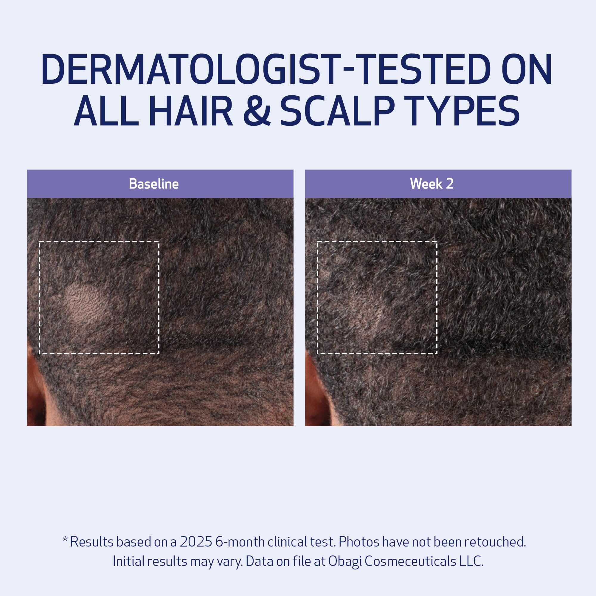 Obagi Nu-Cil BioStim hair close-up showing fuller appearance potential