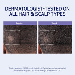Obagi Nu-Cil BioStim hair close-up showing fuller appearance potential