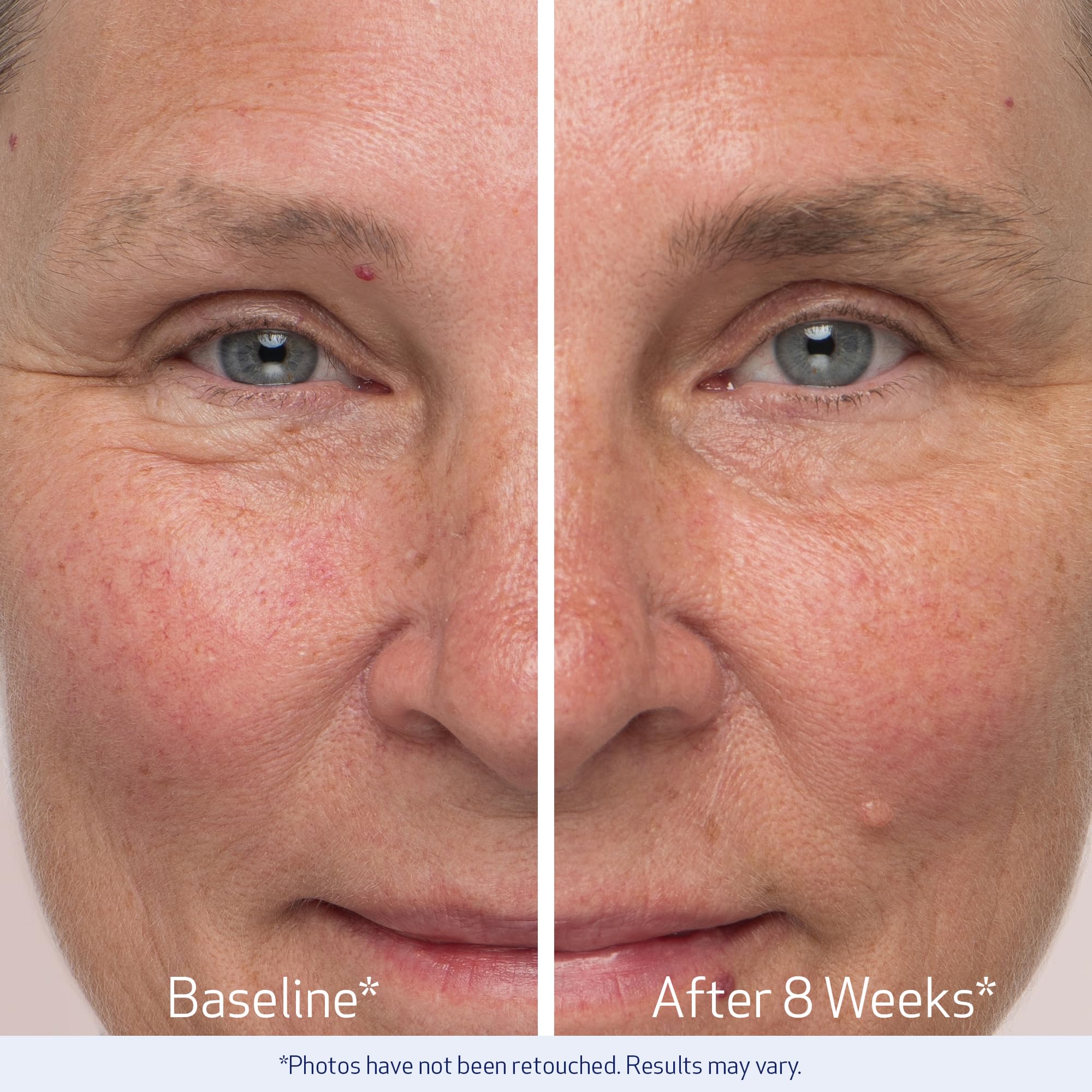 Obagi Nu-Cil week-12 progress photo showing denser brows.