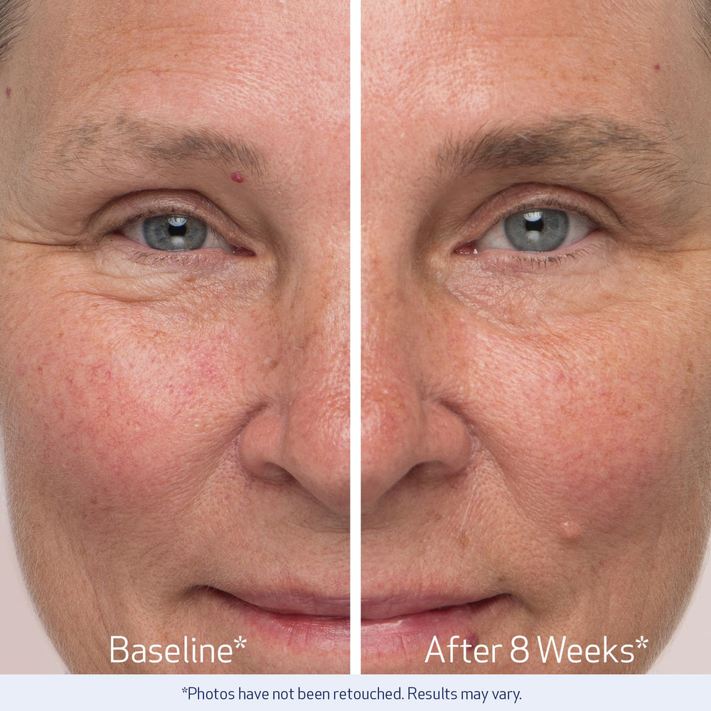 Obagi Nu-Cil week-12 progress photo showing denser brows.