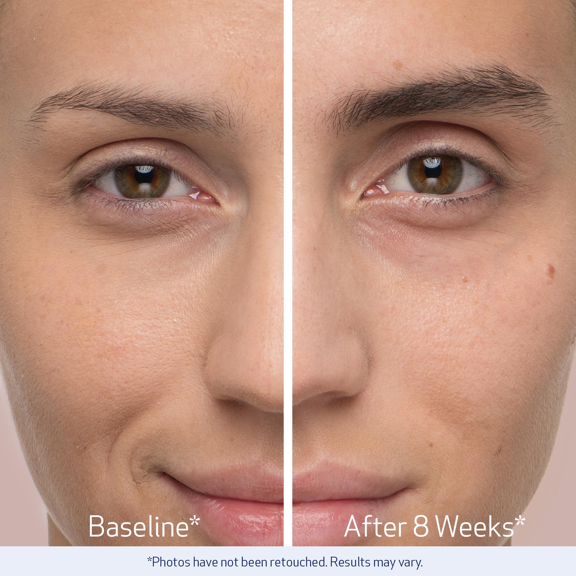 Obagi Nu-Cil week-8 progress photo shows brow fullness trend.