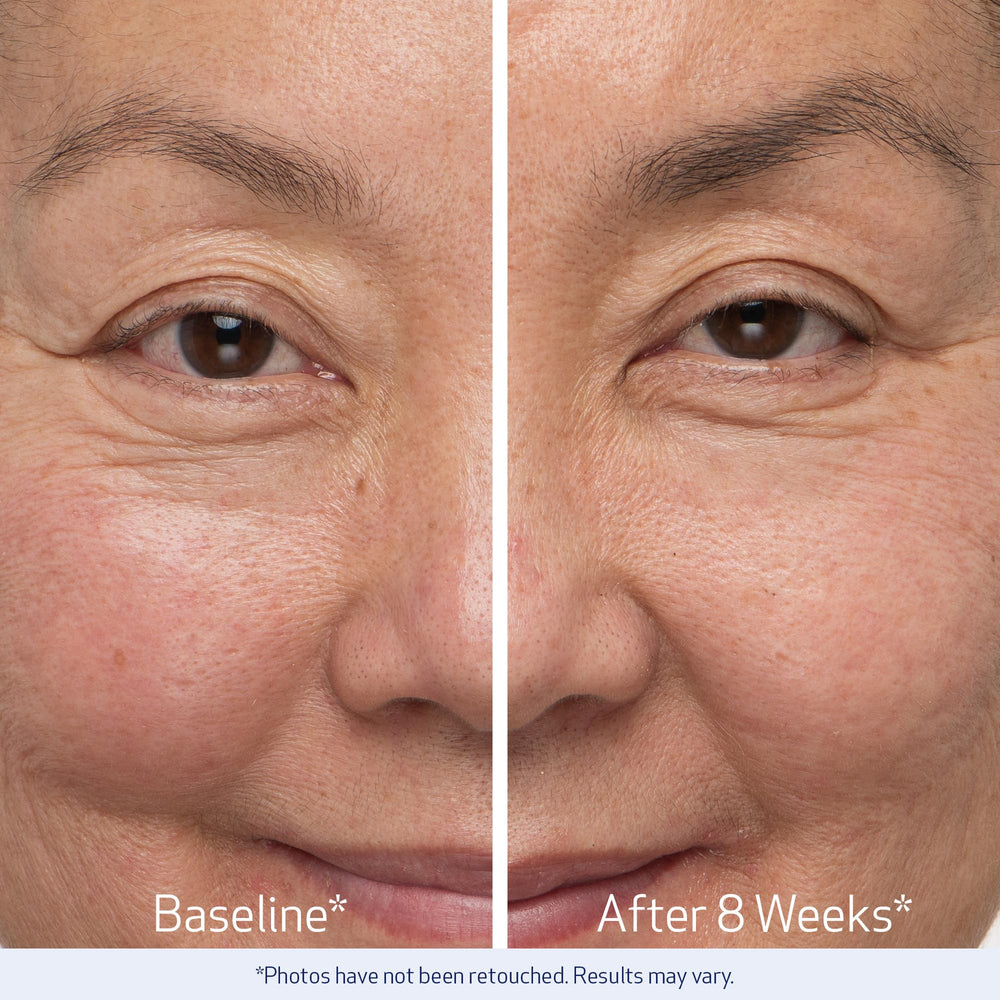 Obagi Nu-Cil brow serum on brow area demonstrating even application.
