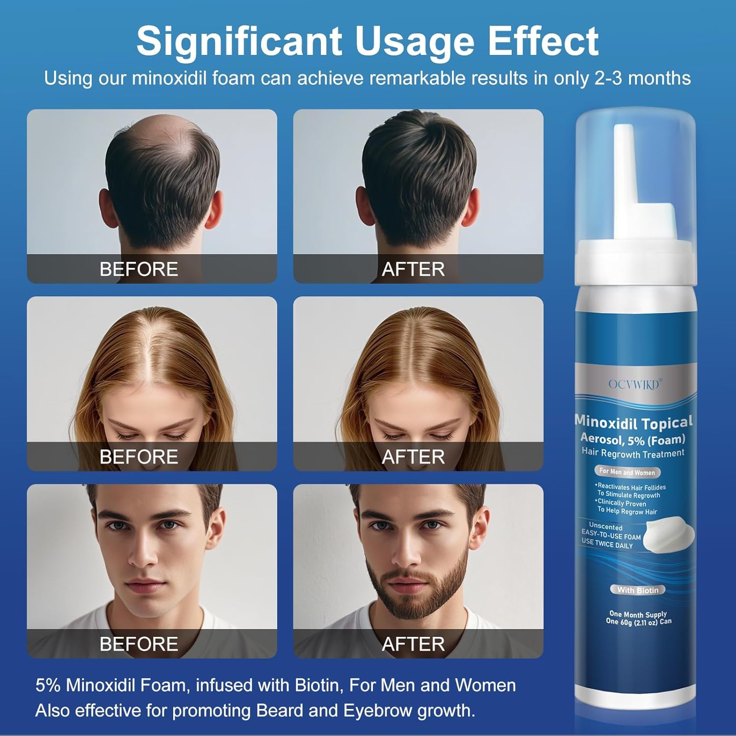 OCVWJKD Biotin-focused formula highlighting nutrient support for healthier hair growth.