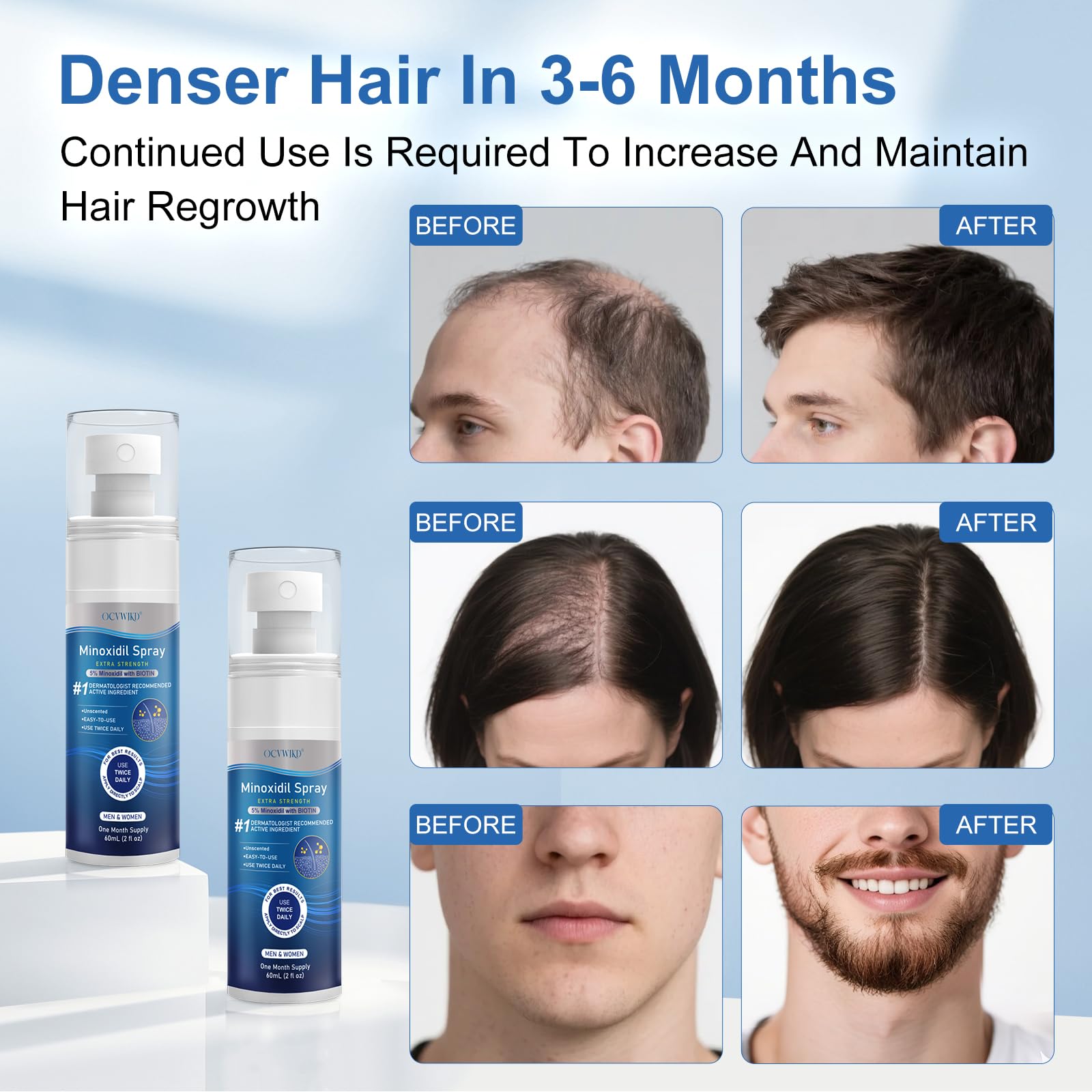 OCVWJKD Minoxidil ingredients bottle detail with Biotin and conditioning components.