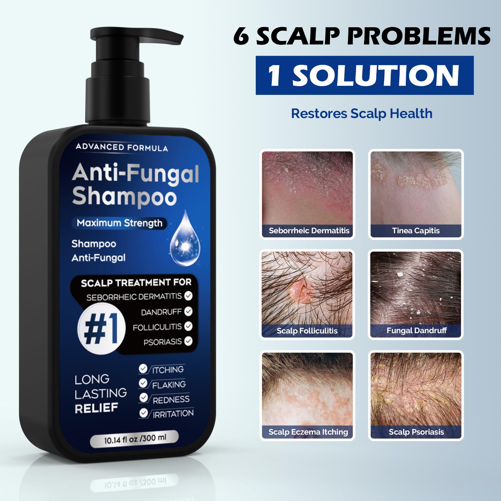 Oely antifungal shampoo label closeup highlighting active ingredients for anti-dandruff benefits