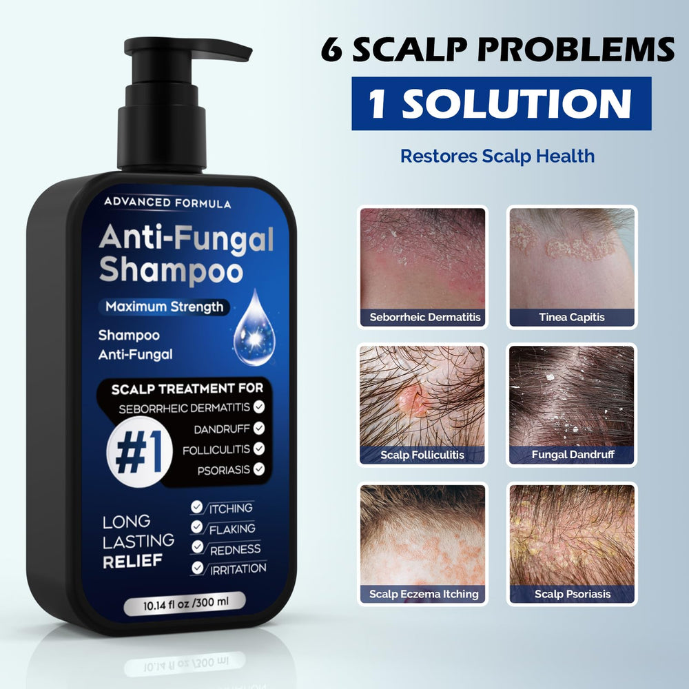 Oely antifungal shampoo label closeup highlighting active ingredients for anti-dandruff benefits