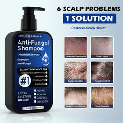 Oely antifungal shampoo label closeup highlighting active ingredients for anti-dandruff benefits