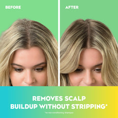 OGX Teatree Mint Shampoo lather close-up shows minty tingling sensation.