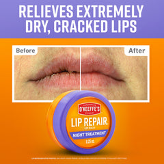 O'Keeffe's reparación de labios nocturna: aplicación suave para labios irritados durante la noche