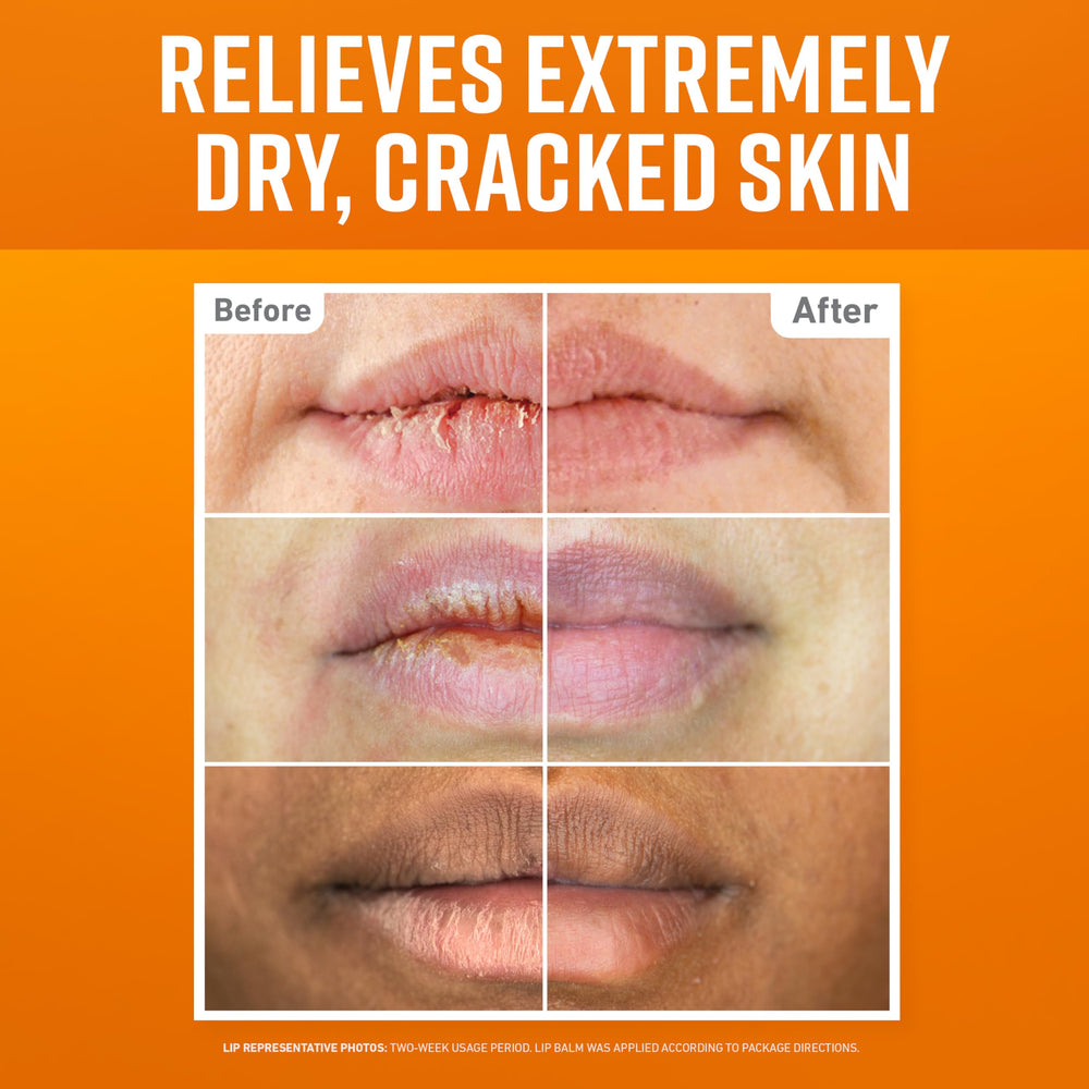 Bálsamo refrescante de O'Keeffe's Lip Repair para alivio rápido