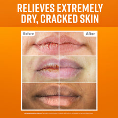 Bálsamo refrescante de O'Keeffe's Lip Repair para alivio rápido