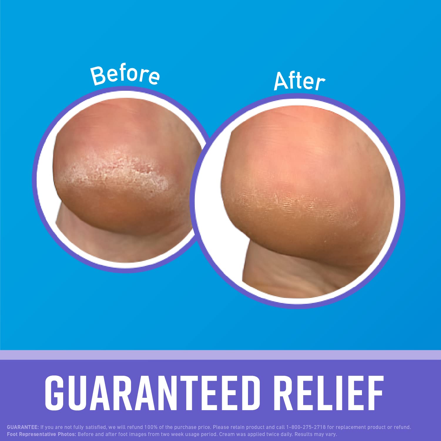 O'Keeffe's Night Treatment packaging with two 7 oz tubes