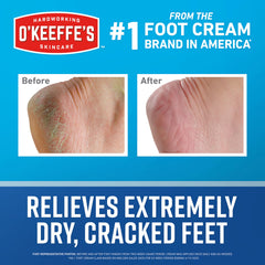 O'Keeffe's Healthy Feet: aplicación de crema en pies para alivio de callos y sequedad