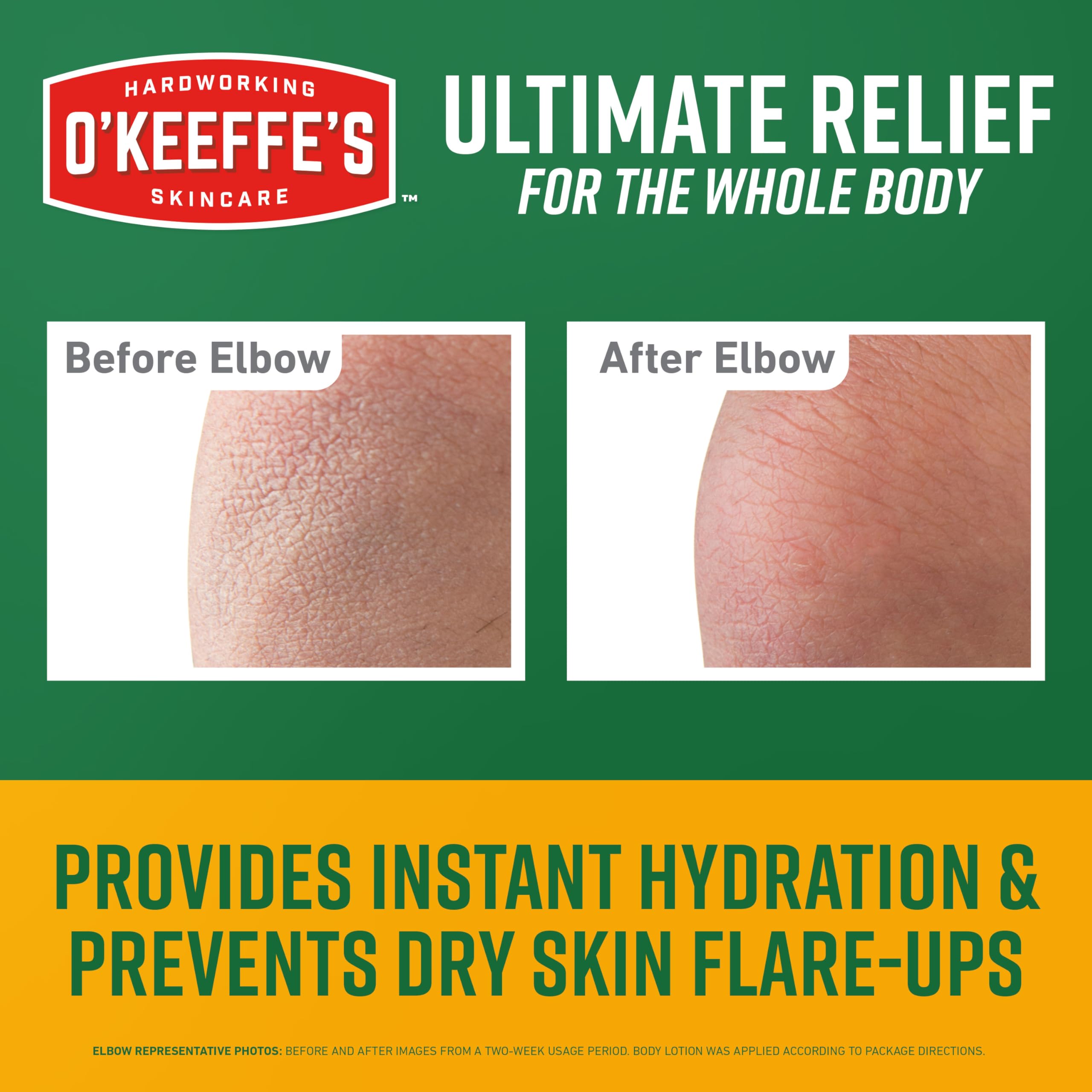 Hidratación 48 horas de O’Keeffe’s Skin Repair para piel agrietada tras duchas.