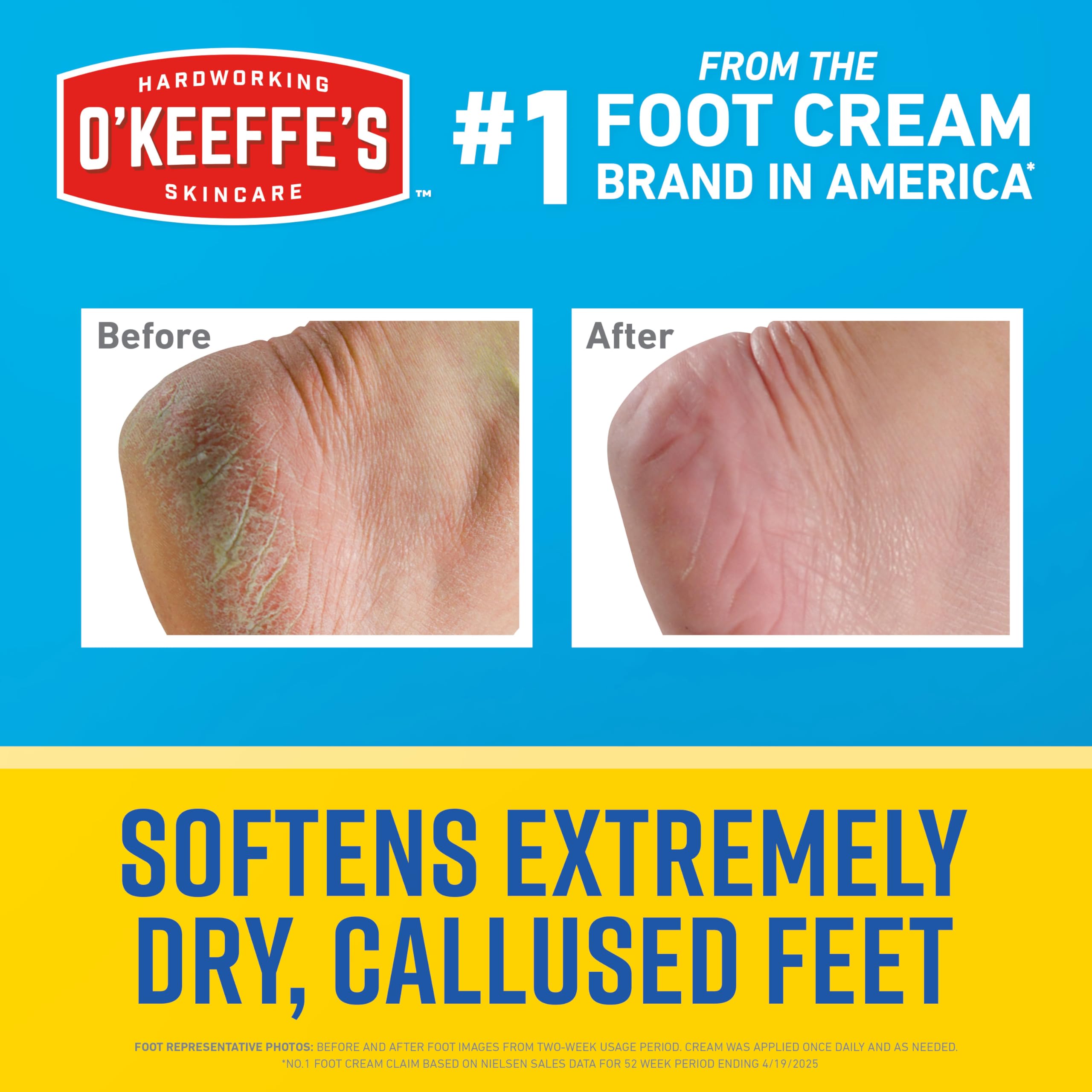 O'Keeffe's Urea hydration boost moisturizes dry skin on feet