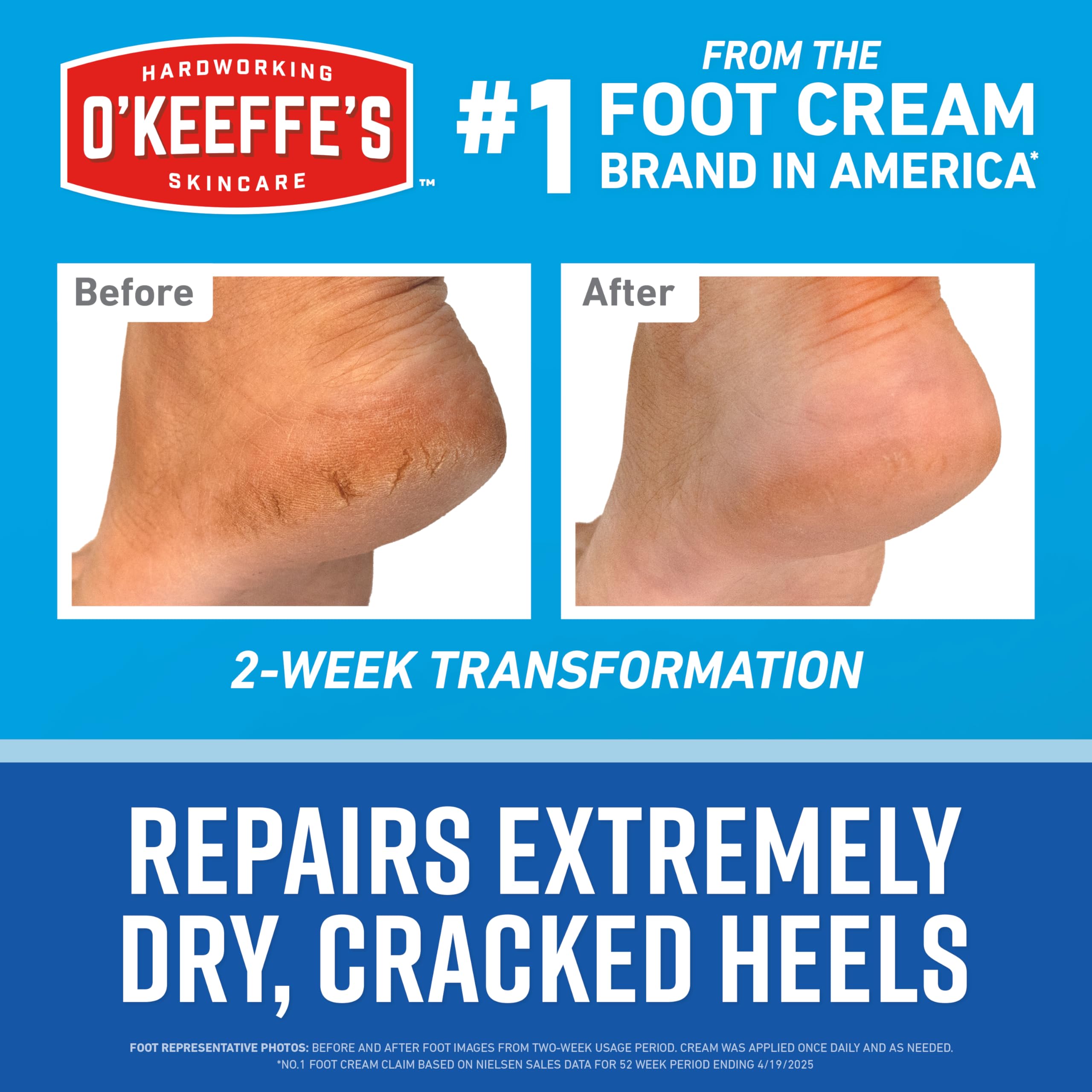 O'Keeffe's con urea y ácido láctico para hidratación suave