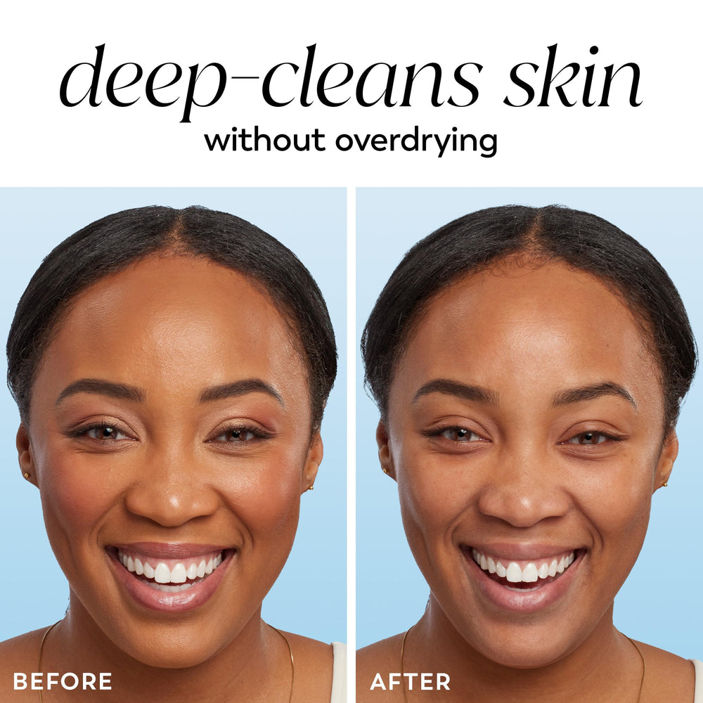 Olay Cleansing Melts Gentle para piel sensible: dermatológicamente probada y apta.