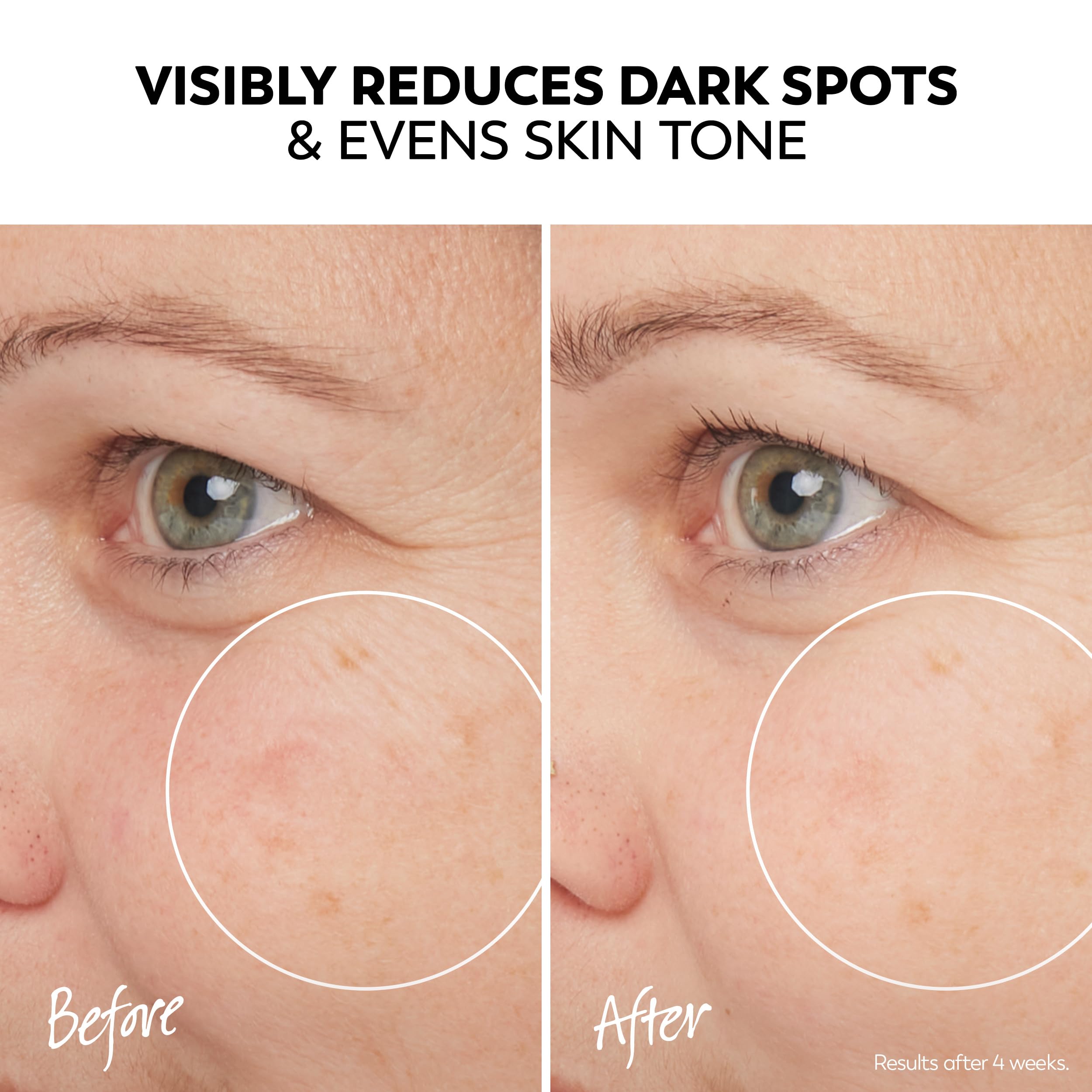 Niacinamide ingredient panel highlights skin barrier support in Olay Pro-X.