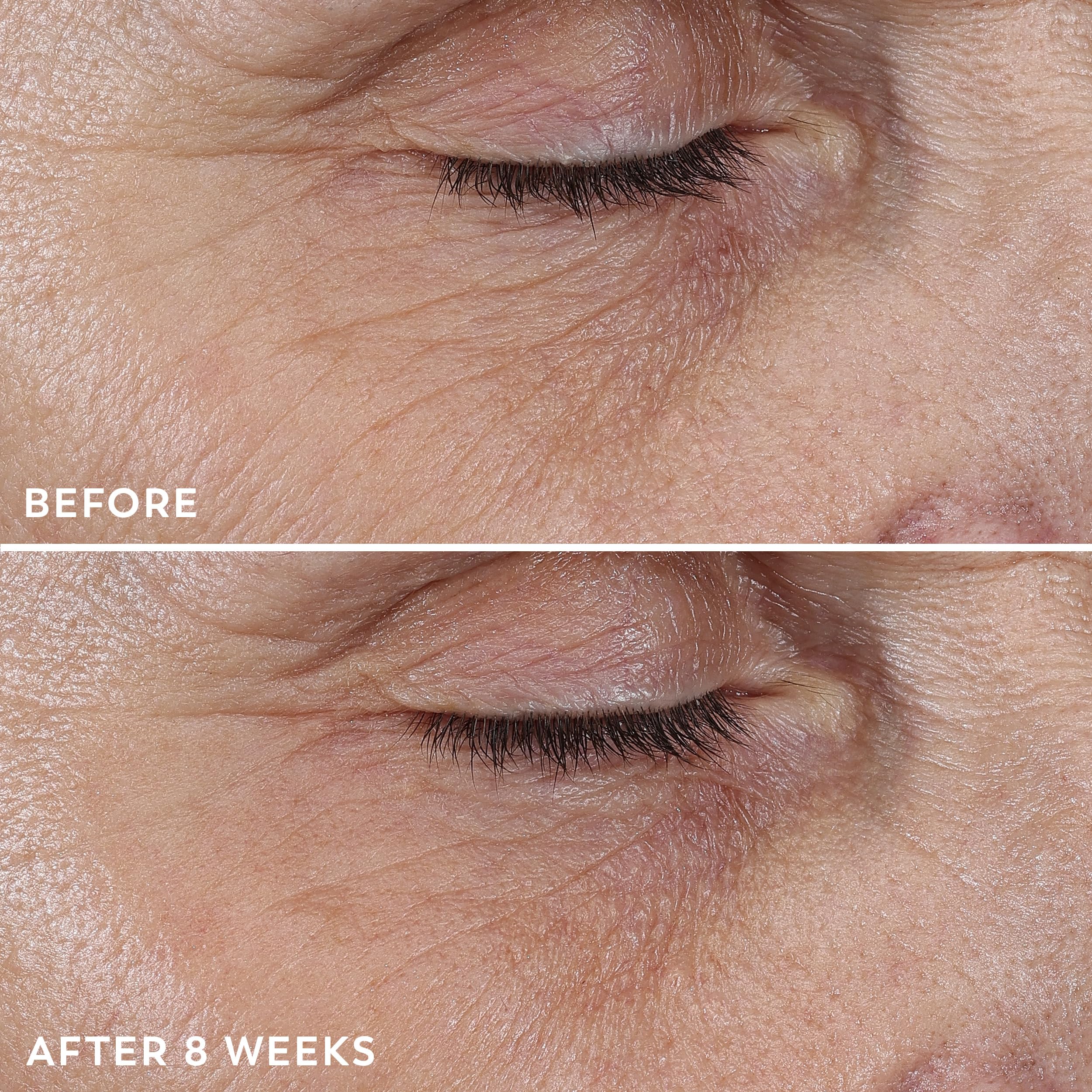 Olay Regenerist clinical test badge communicates tested results.