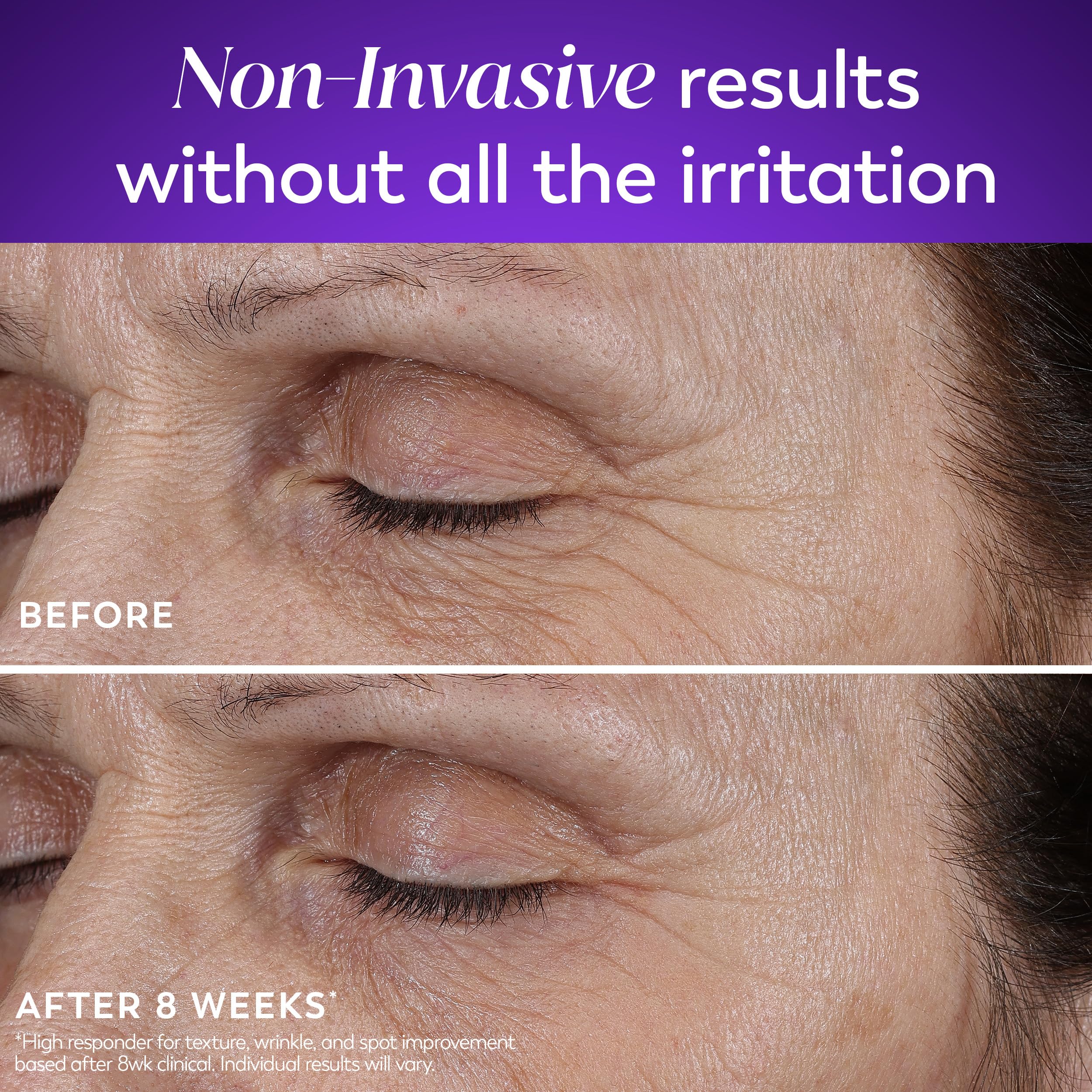 Before and after look at Olay Regenerist Retinol24 Max potential texture improvements
