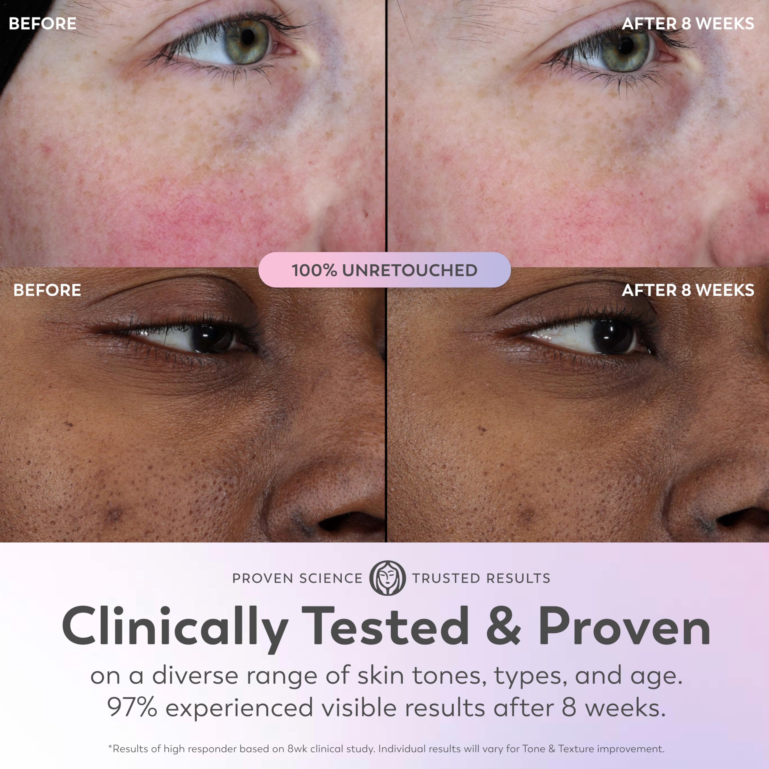 Olay Super Serum tono más uniforme con uso habitual.