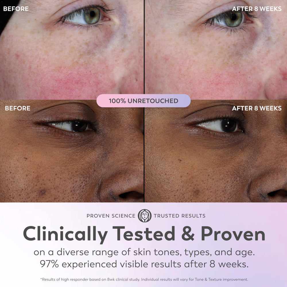 Olay Super Serum tono más uniforme con uso habitual.