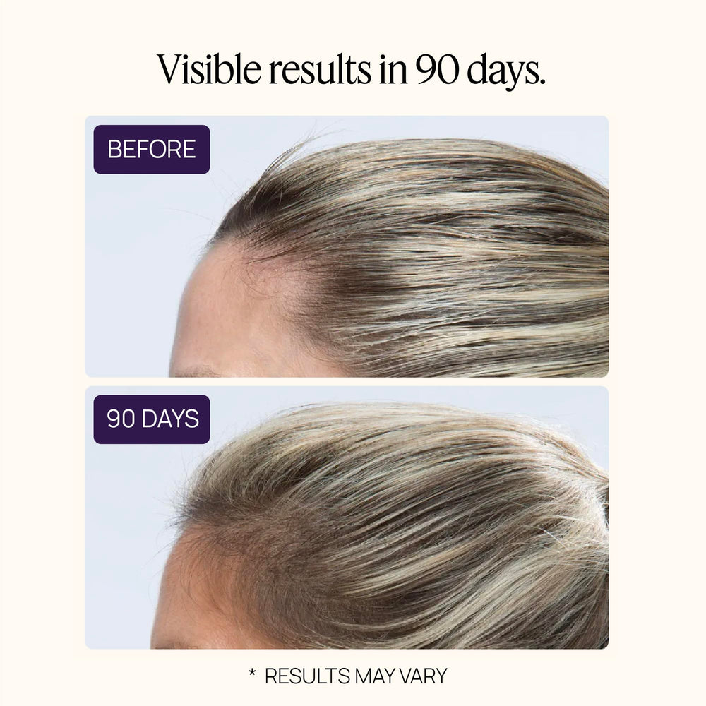 OMI WellBeauty clinical-study graph illustrating evidence