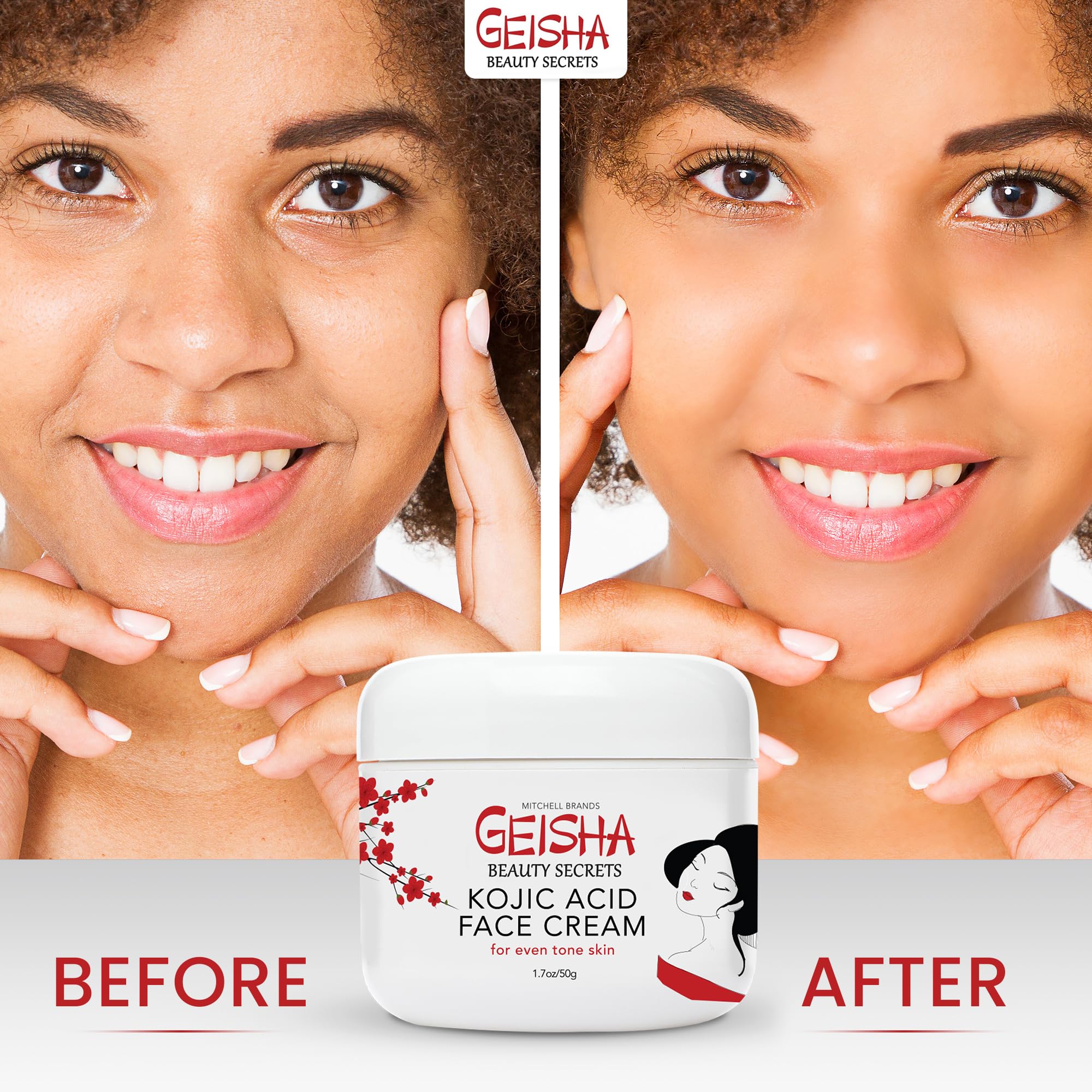 Complementa el tratamiento con protector SPF 50 para evitar manchas.