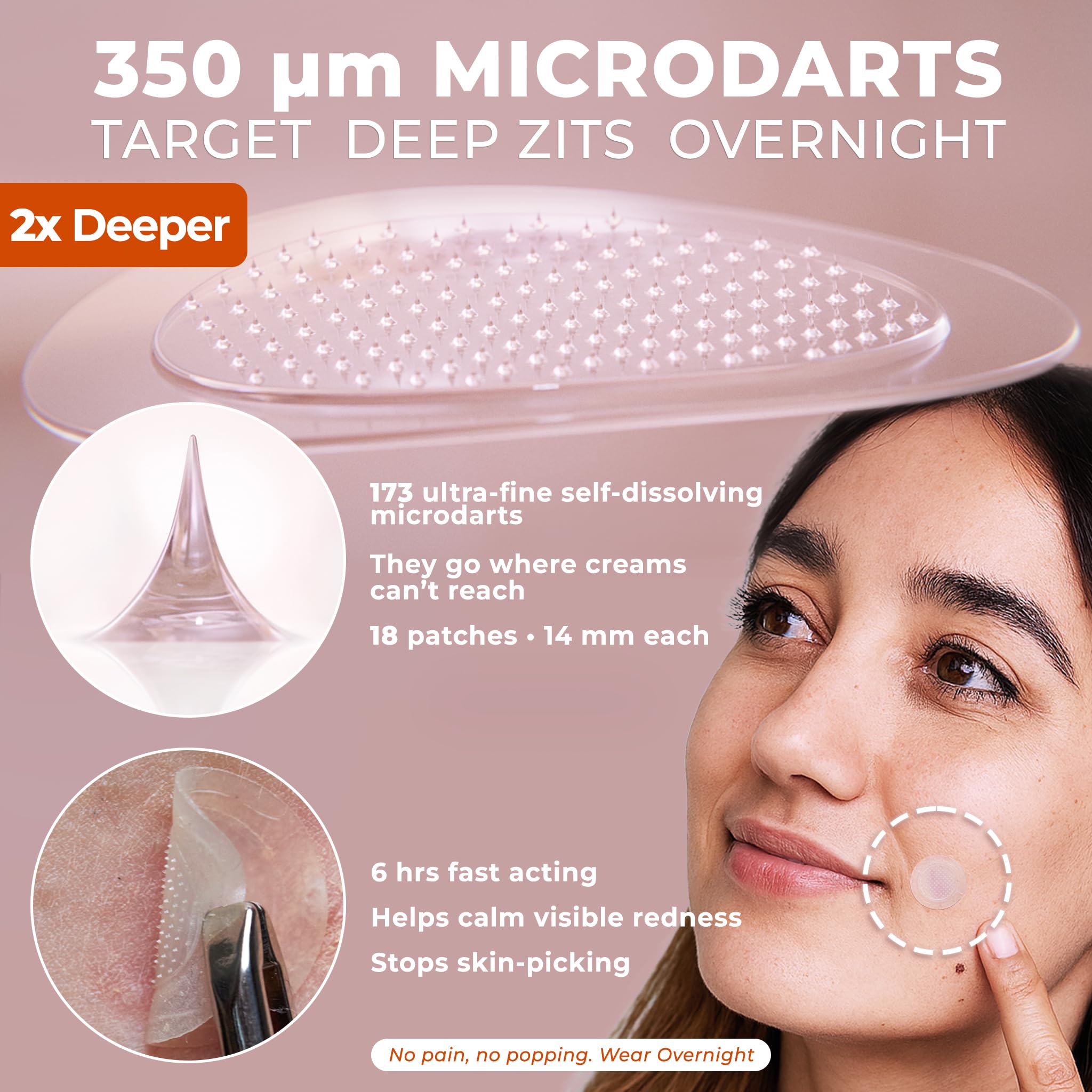 OMMA 17mm zit sticker size for early-stage blemishes.