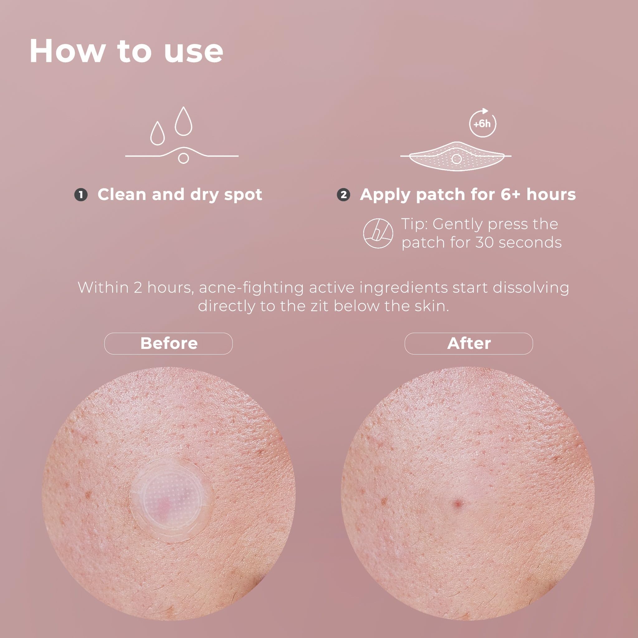 OMMA deep blemish action at night targets stubborn zits.
