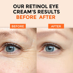 +1HEROLABS crema de ojos, aplicación suave alrededor de los ojos para piel sensible