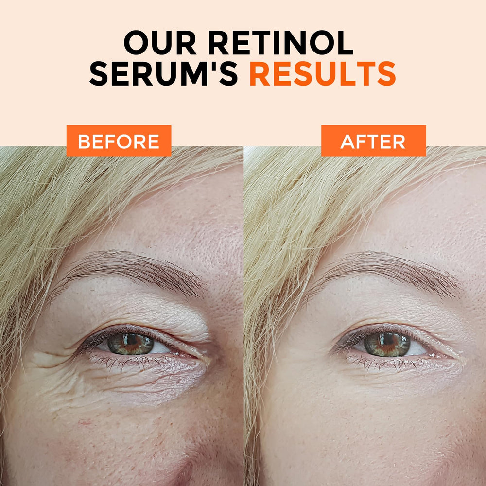 OneHerolabs Retinol Serum, rutina nocturna segura para piel sensible