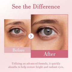 Onespring Crema para Ojos, ácido hialurónico, hidratación duradera