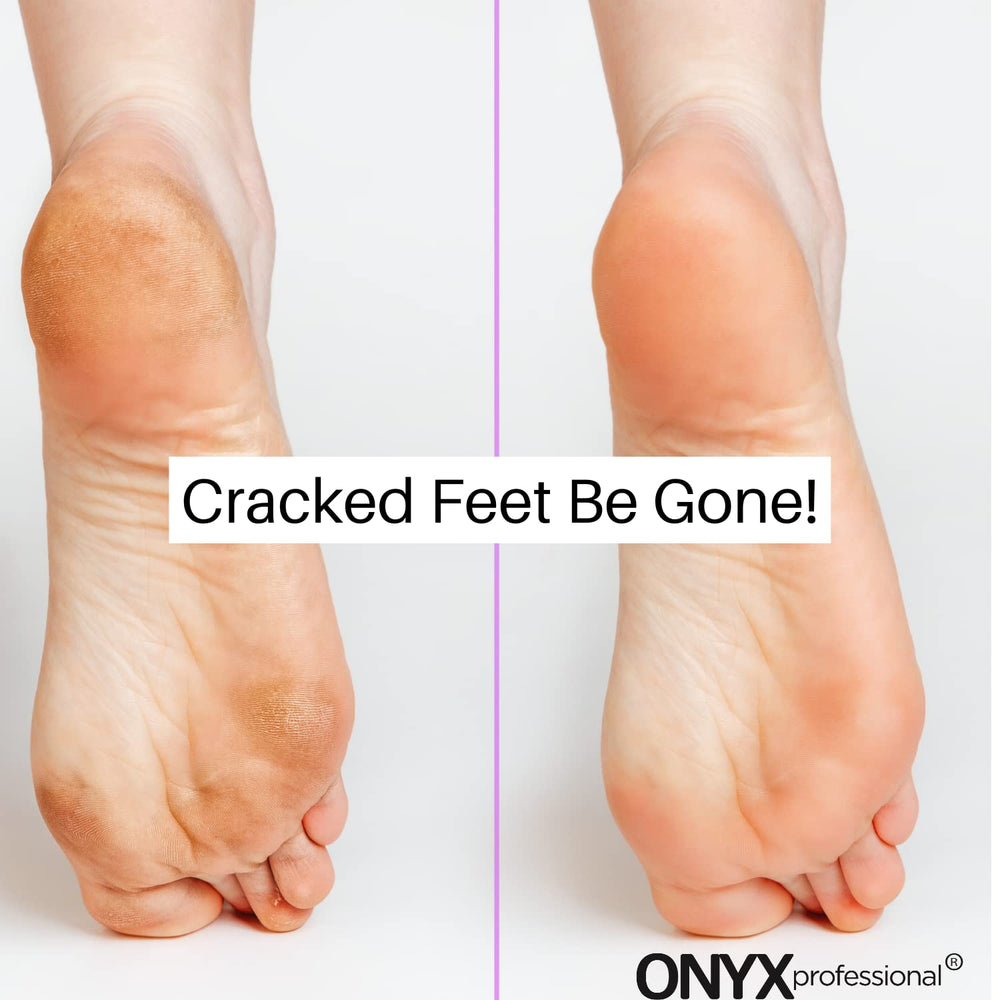Calcetines gel talla única Onyx Professional, ajuste para la mayoría de pies.