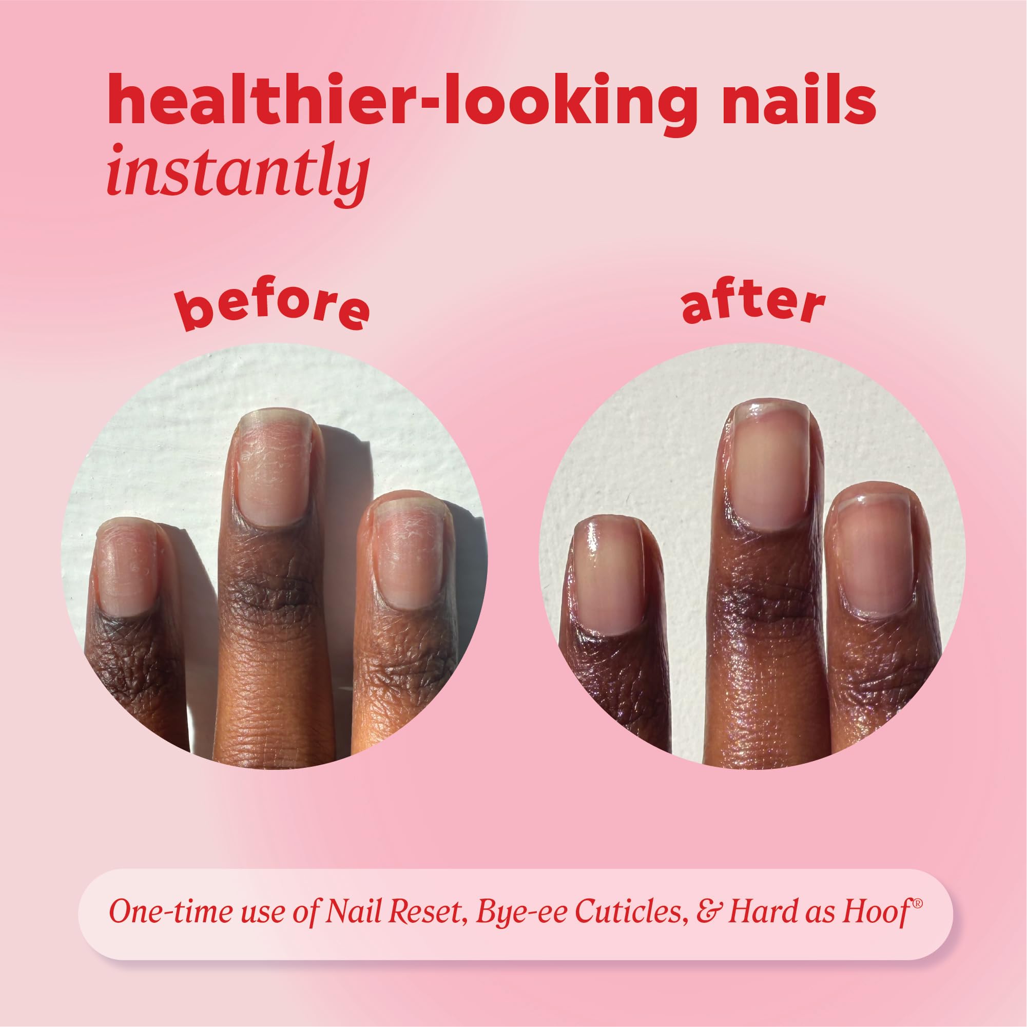 Onyx Professional Hard as Hoof repara daño de uñas tras esmaltes o gel.