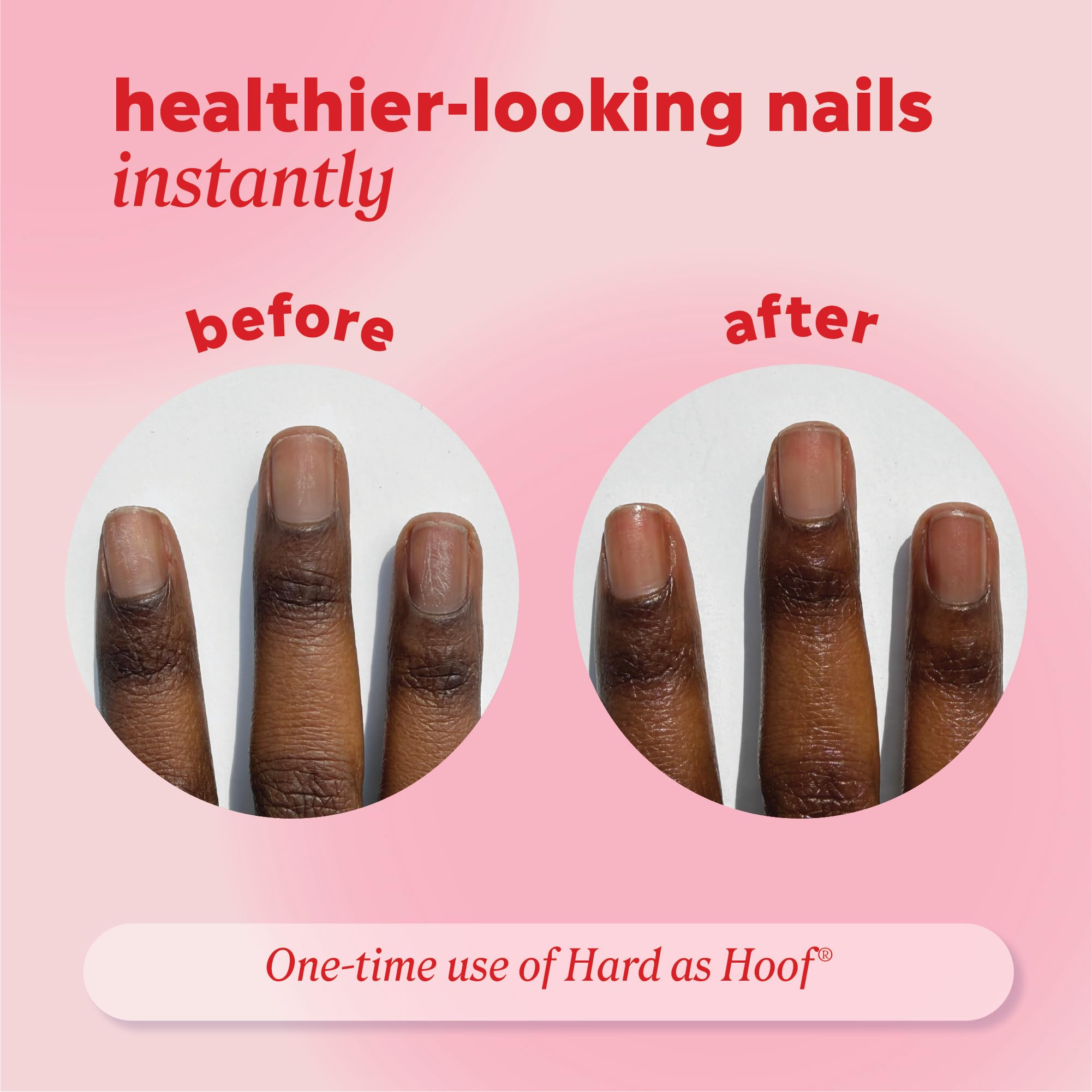 Onyx Professional resultados rápidos, uñas más fuertes tras uso regular.
