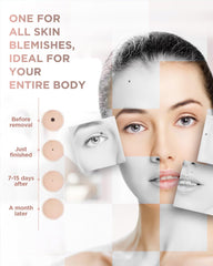 OPHERA treatment area spotlight helps target skin spots accurately.