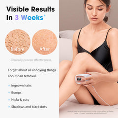 Oreeth device ice-cooling plate cools skin during painless sessions.