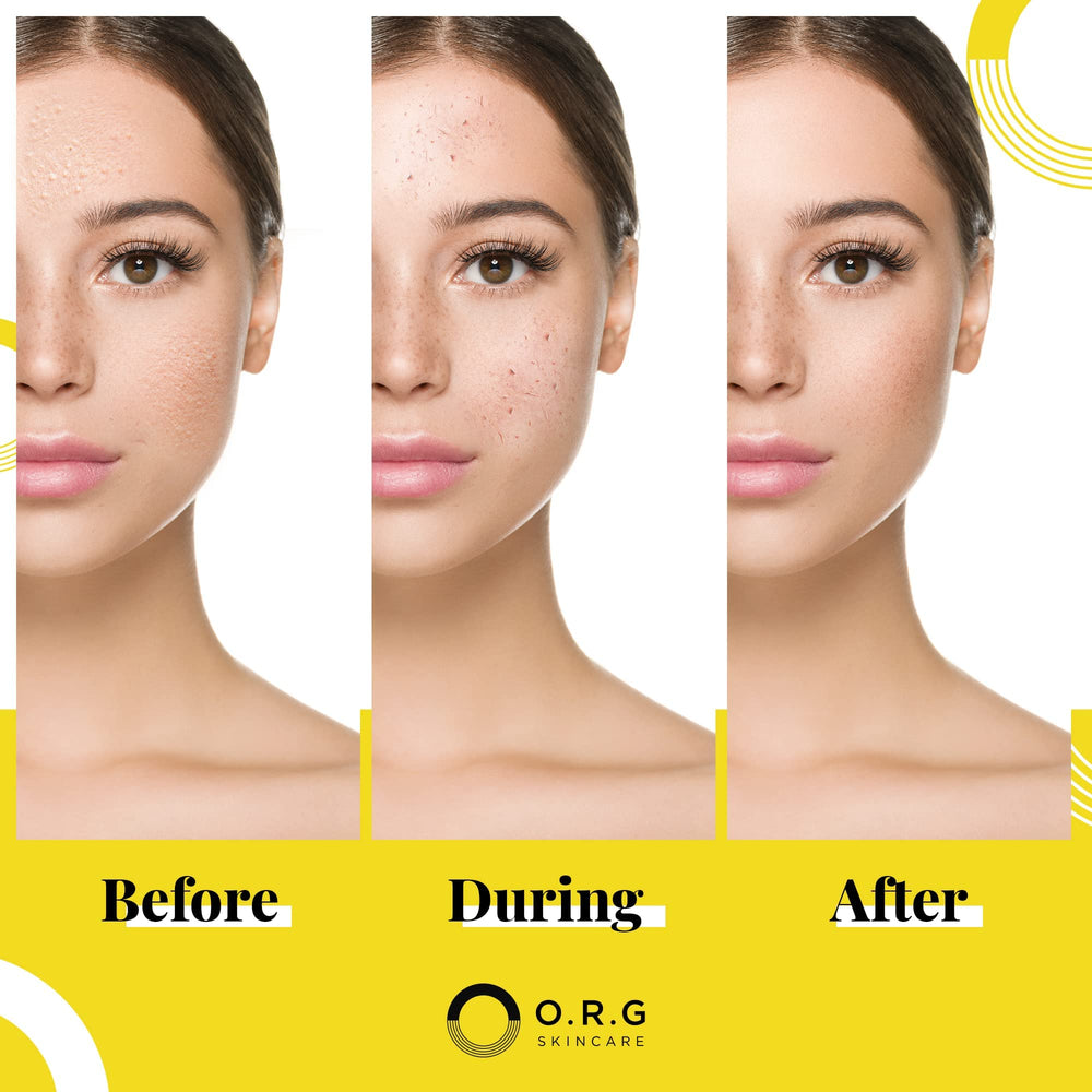 O.R.G. SP-Powder mineral active ingredient highlighted for gentle renewal.