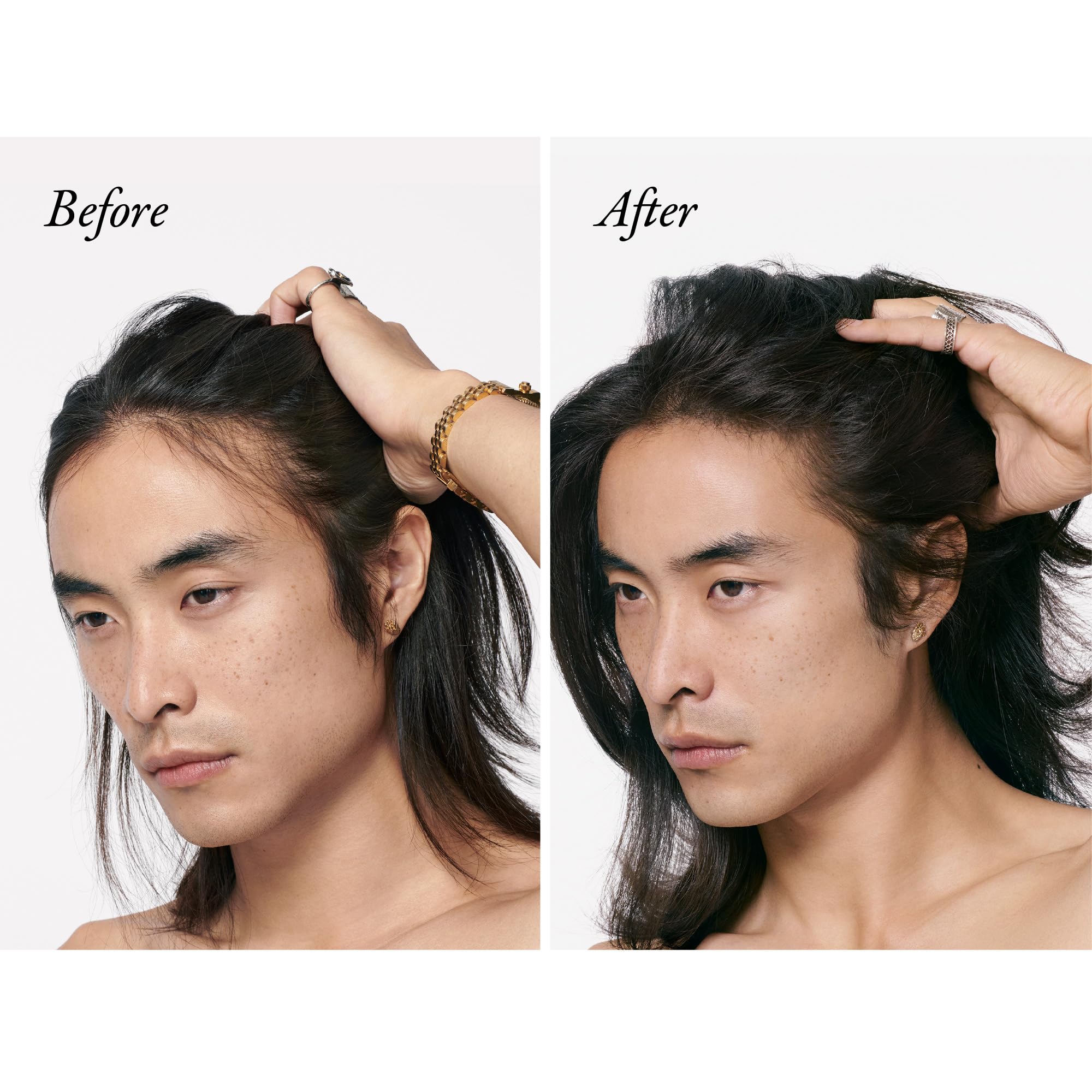Oribe Serene Scalp Densifying Treatment Spray: rociado suave que estimula la densidad capilar.