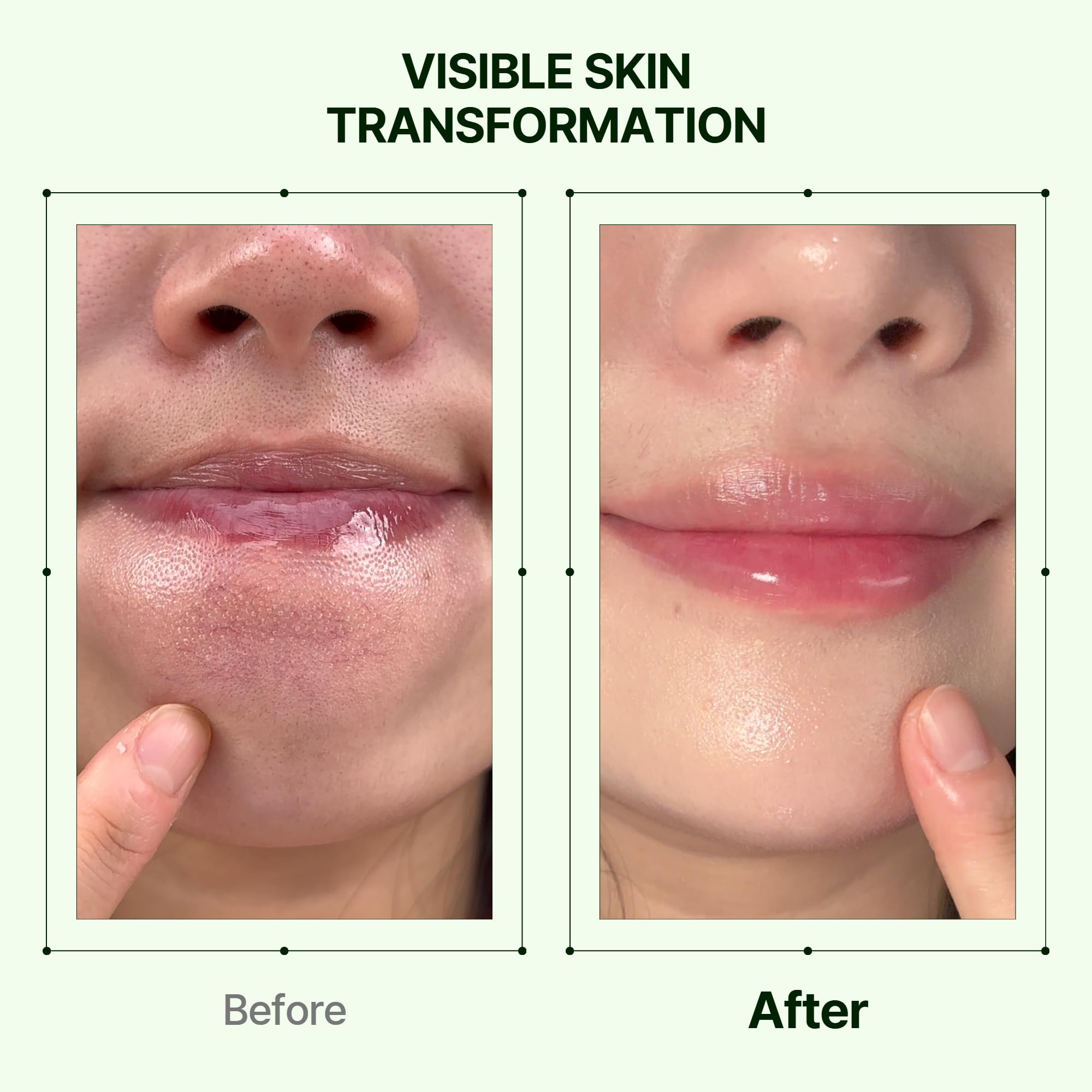 Orien Mugwort Zero Film: exfoliación suave con 0,5% BHA para controlar el sebo.